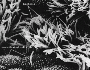 Pertussis infecting cilia